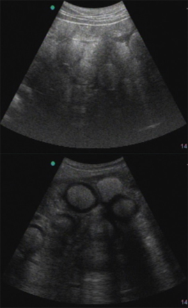 図-3　雌アカウミガメ生殖腺の超音波画像