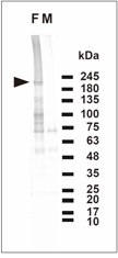 ２．抗卵黄タンパク抗体を利用した板鰓類卵胞サイズの推定の試み