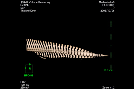 ３．CT検査を用いた骨学的構造の把握