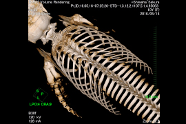 ３．CT検査を用いた骨学的構造の把握