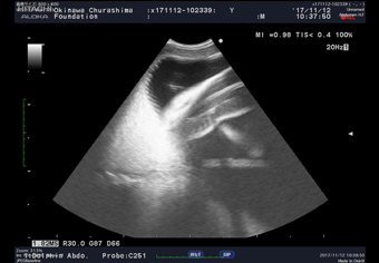 図-2子宮内を泳ぐオオテンジクザメ胎仔（右上）のエコー画像
